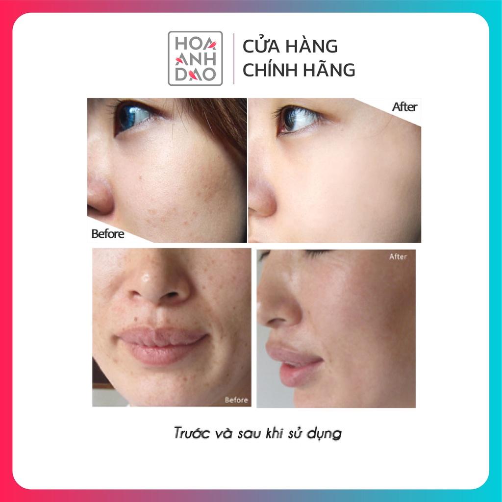 Kem giảm nám Sakura Transforming Cream chính hãng Nhật Bản 30g