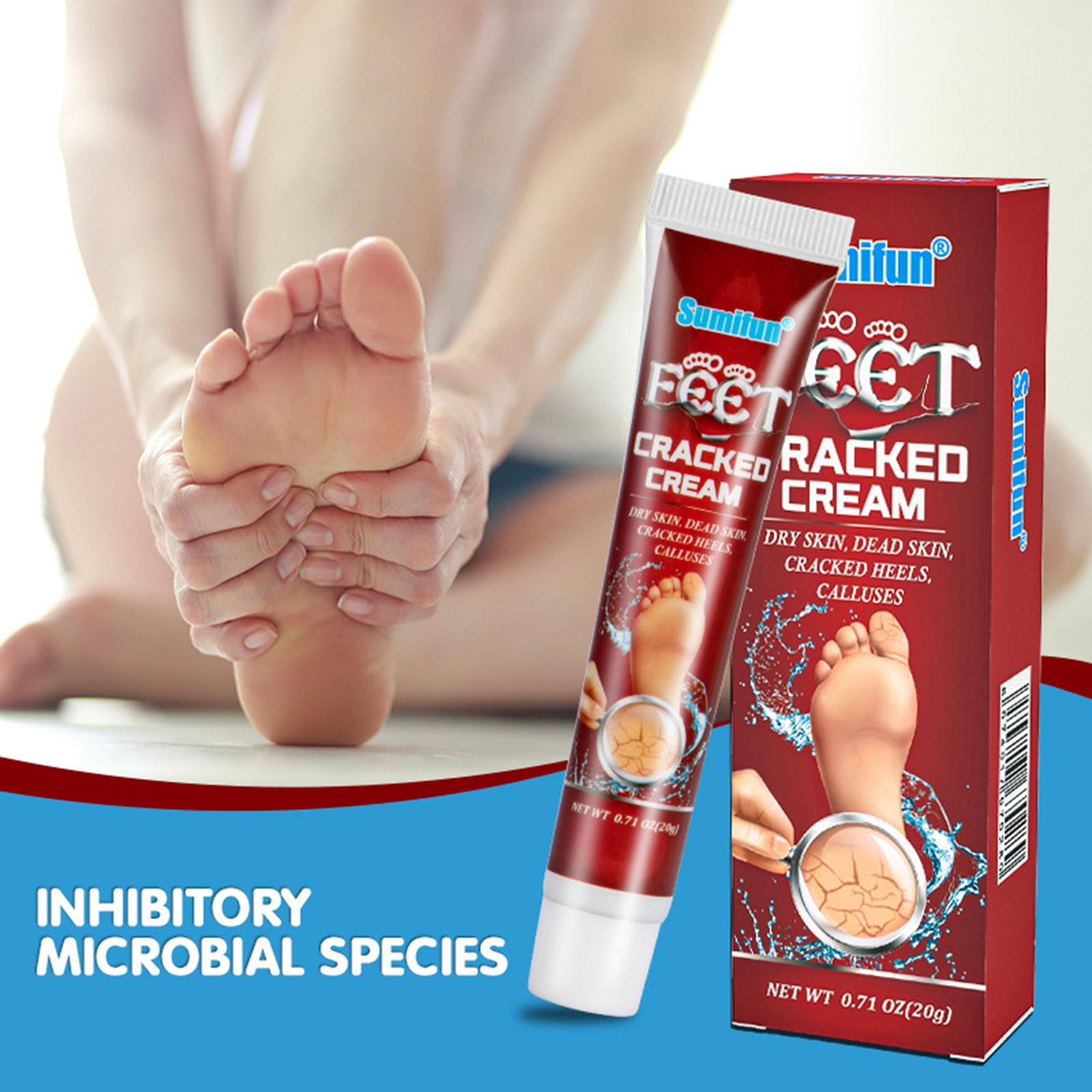 Chaps and Cracked Hands and Feet Cream Dry Crack Anti-Freeze Crack Turtle Cream