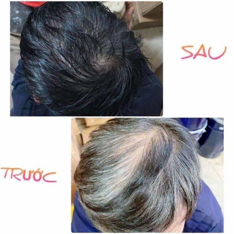 Phủ Đen Tóc 500ML – Giúp Tóc Trông Đều Màu, Bóng Mượt & Dễ Chăm Sóc Ngay Tại Nhà