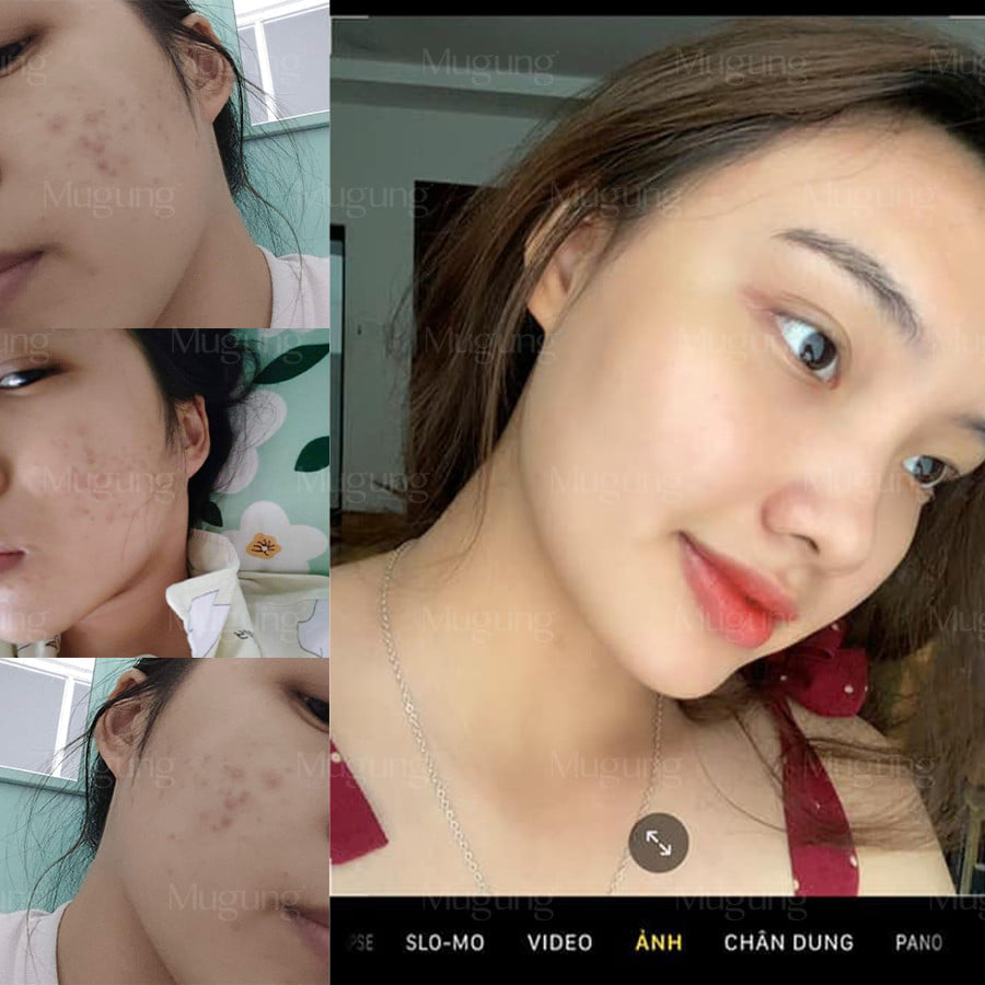 Mugung Serum Dưỡng Trắng tinh chất vàng 24K Brightening Hydra serum Giúp Sáng Da, Mờ Thâm, Dưỡng Ẩm, Làm Chậm Quá Trình Lão Hóa