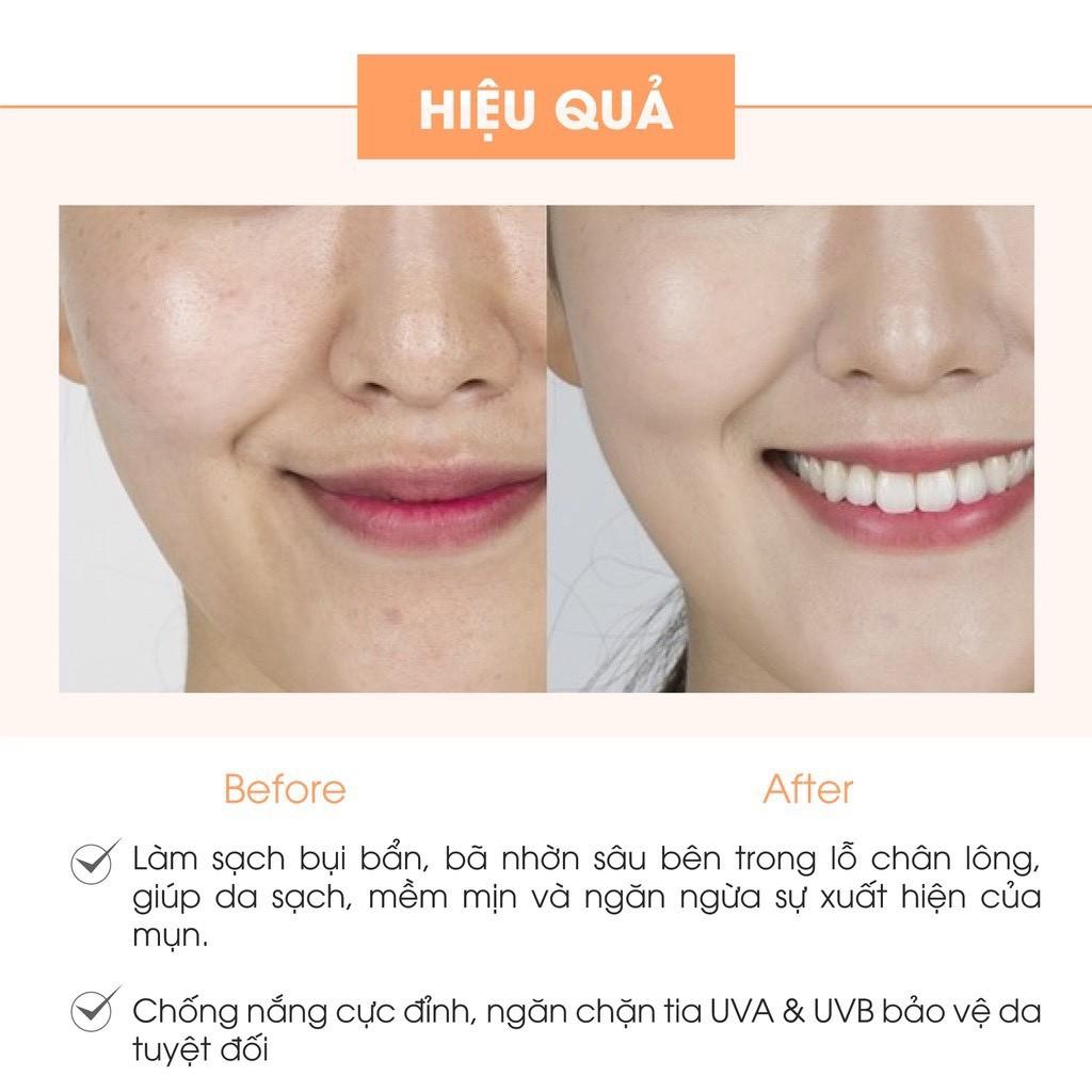 Combo 2 món: Sữa rửa mặt trà xanh + Kem face pháp