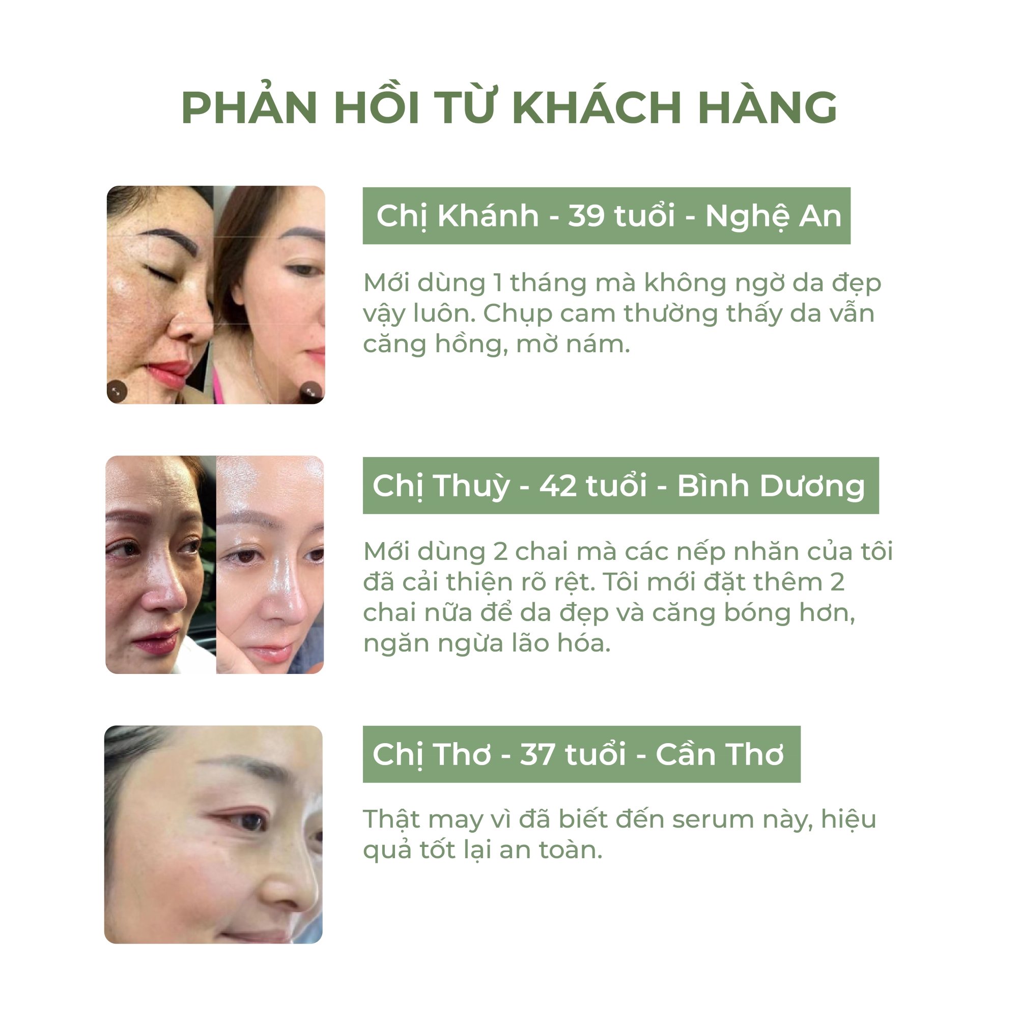 [COMBO 2] Serum Trẻ Hóa  Abera Cung Cấp Dưỡng Chất, Chống UV, Làm Sáng Da, Giảm Nếp Nhăn, Tái Tạo Tế Bào Da