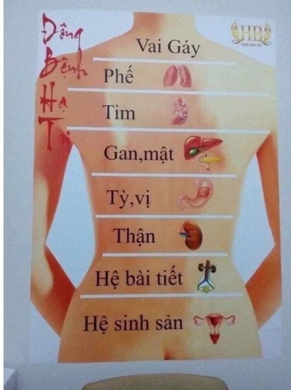 Bộ giác hơi ngải cứu cao cấp 6 cốc - VỪA GIÁC HƠI- VỪA CỨU NGẢI.giúp ôn ấm bài trừ hàn lạnh và lưu thông khi huyết