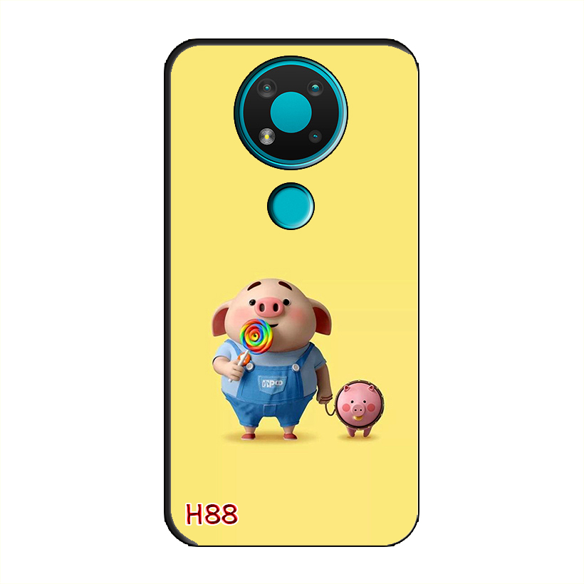 Ốp Dẻo Dành Cho NOKIA 3.4