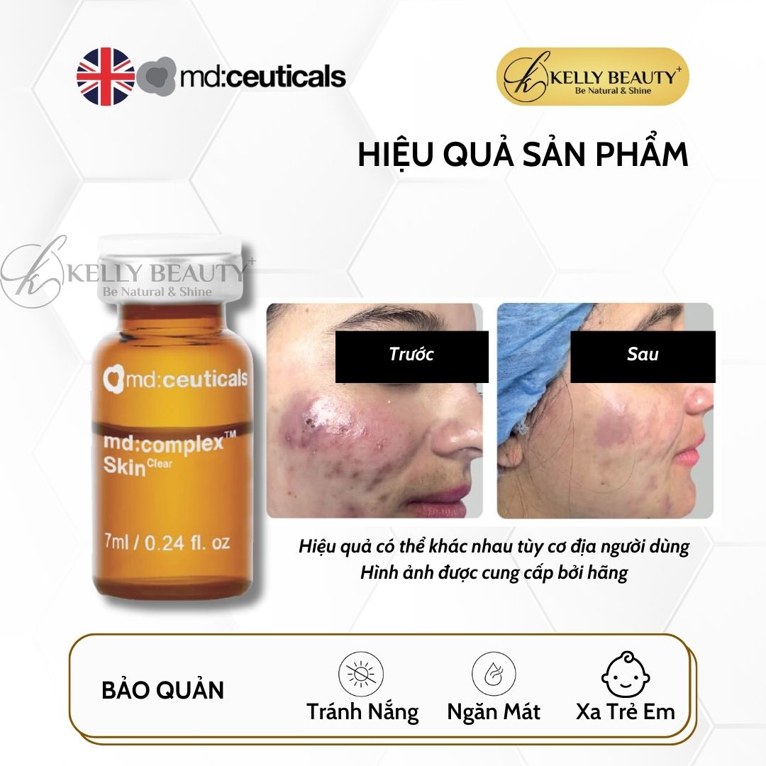 Meso Cho Da Mụn MD:COMPLEX Skinclear - md:ceuticals Mesotherapy | Kelly Beauty