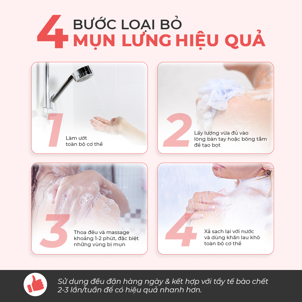 Sữa Tắm Khỏi Mụn Lưng Oriss Giảm Thâm Mụn, Viêm Nang Lông Chai 300ml