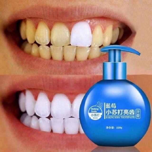 Kem Làm Trắng Răng Baking SoDa - Tẩy Vết Ố Vàng , Mảng Bám ,Vôi Răng Vị Hoa Qủa