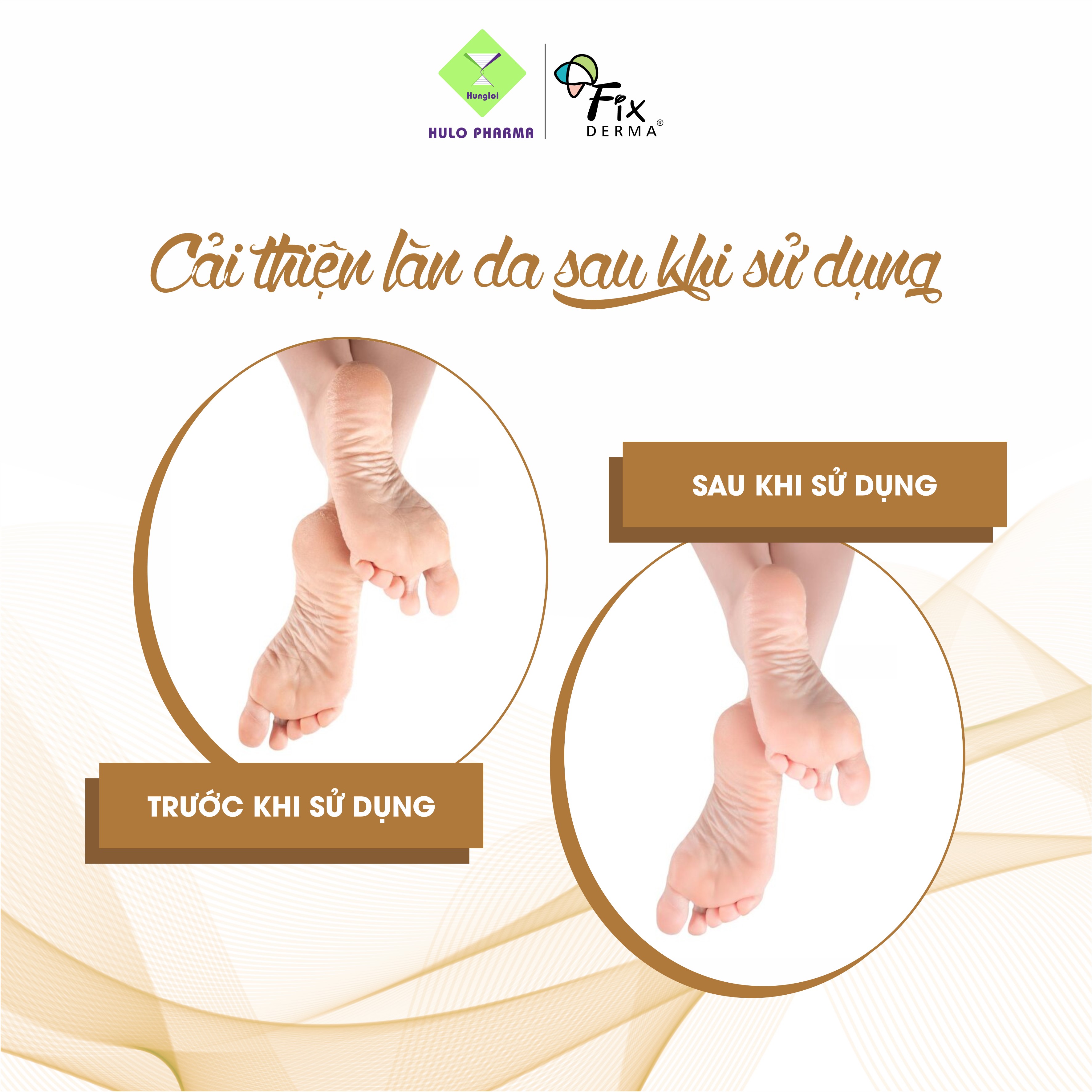 Kem Dưỡng Mềm Mịn, Chống Nứt Nẻ Gót Chân Fixderma Foot Cream - 60gr