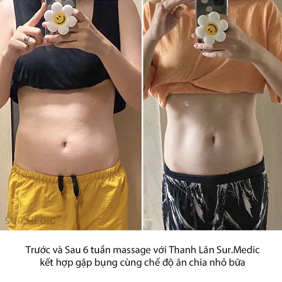 Thanh Lăn Massage Tan Mỡ Săn Cơ Định Hình Body SUR.MEDIC Cream 100ml