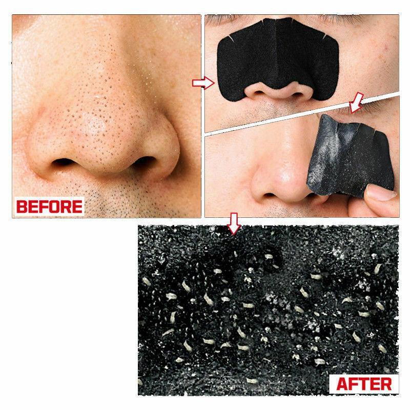 [Siêu Sale Cận Date] Bộ Lột Mụn Đầu Đen 3 Bước Holika Holika Pig Nose Clear Black Head Strong 3g