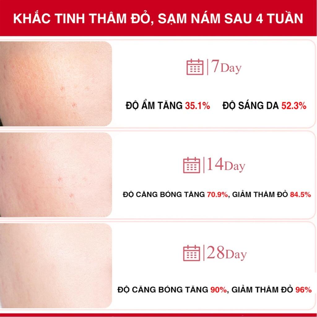 Kem Dưỡng Mờ Nám Chuyên Sâu Angel's Liquid Tranexamic Mela Cream 50ml