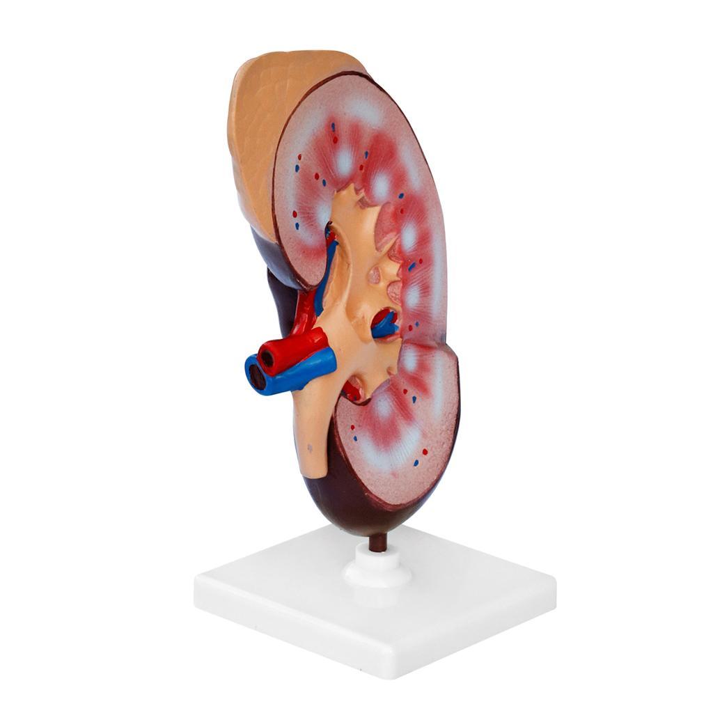 Kidney Anatomical Anatomy Kidney Model Expansion Display Teaching Supplies