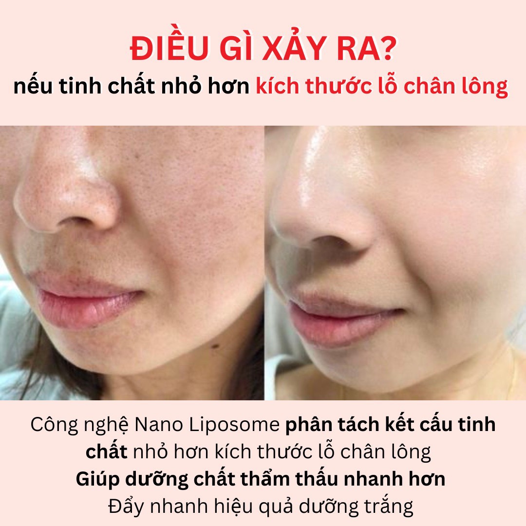 Serum Ampoule Lanci dưỡng trắng da chống lão hoá, giảm nếp nhăn, phục hồi tái tạo da - 50ml