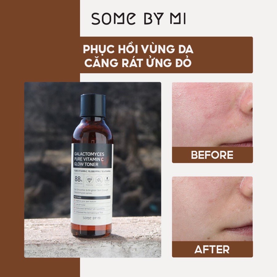 Nước Hoa Hồng Dưỡng Trắng, Chống Lão Hóa SomeByMi Galactomyces Pure Vitamin C Glow Toner 200ml