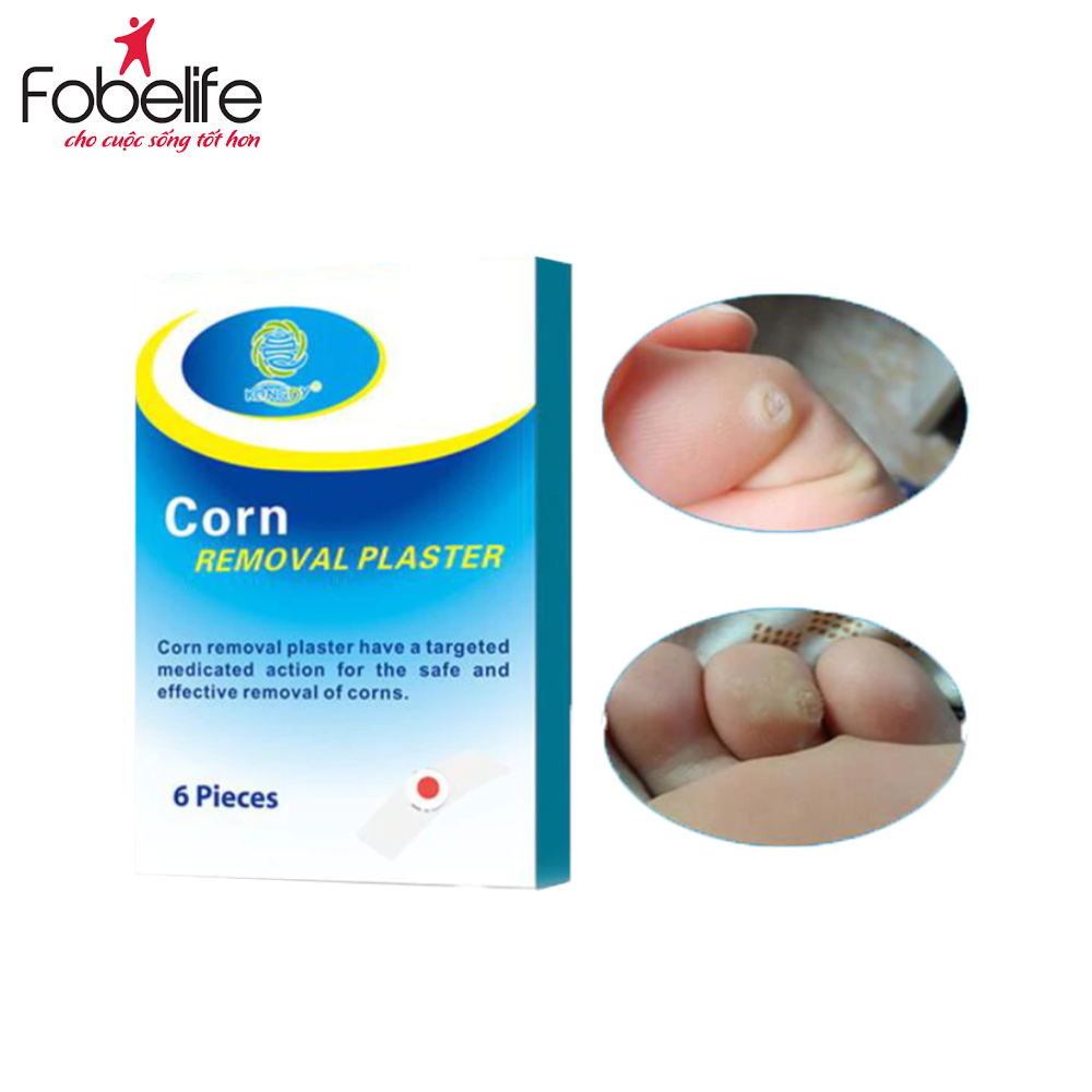 Miếng Dán Mụn Cóc Loại Bỏ Mụn Cóc Tại Nhà An Toàn Corn Removal Plaster ( Hộp 6 miếng )