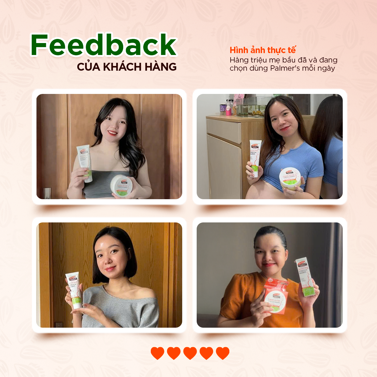 Bơ dưỡng ẩm rạn da cuối thai kỳ Palmer's 125g