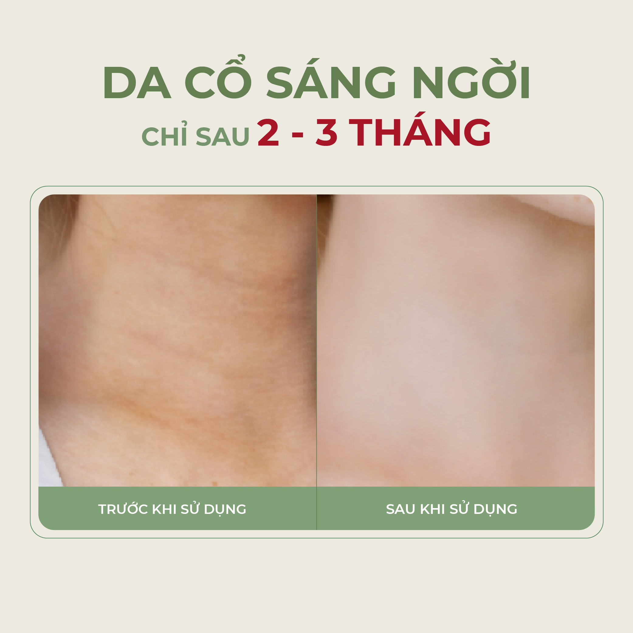 Kem Dưỡng Da Cổ Loka Nano Abera 50ML Có Lăn Massage Chăm Sóc, Phục Hồi Da Cổ, Lấy Lại Vẻ Đẹp Trắng Sáng