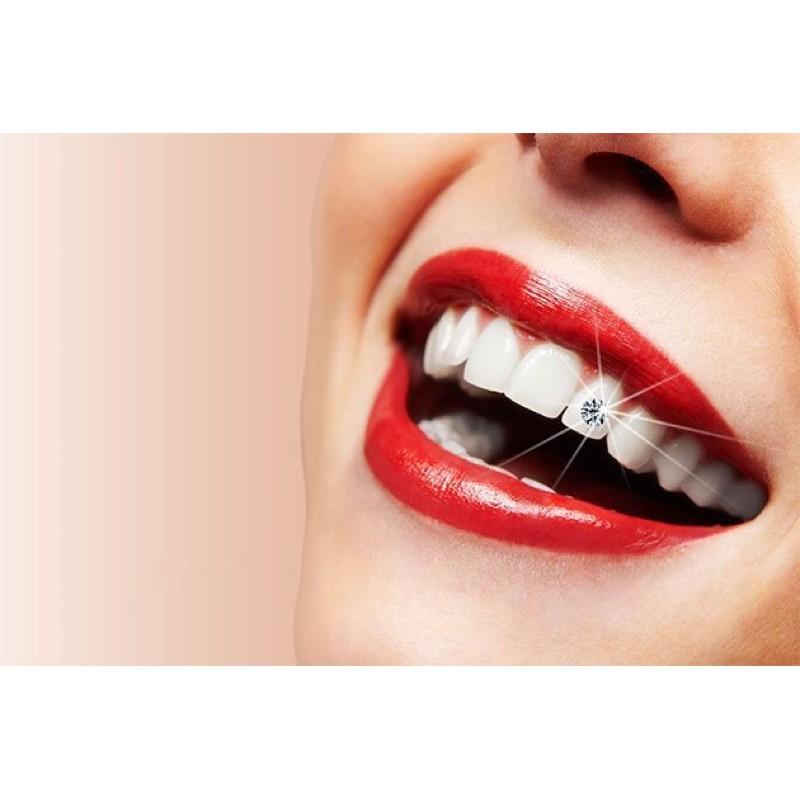 Đá gắn răng (Kim cương nhân tạo Moissanite 2.5-3.0) hàng đẹp