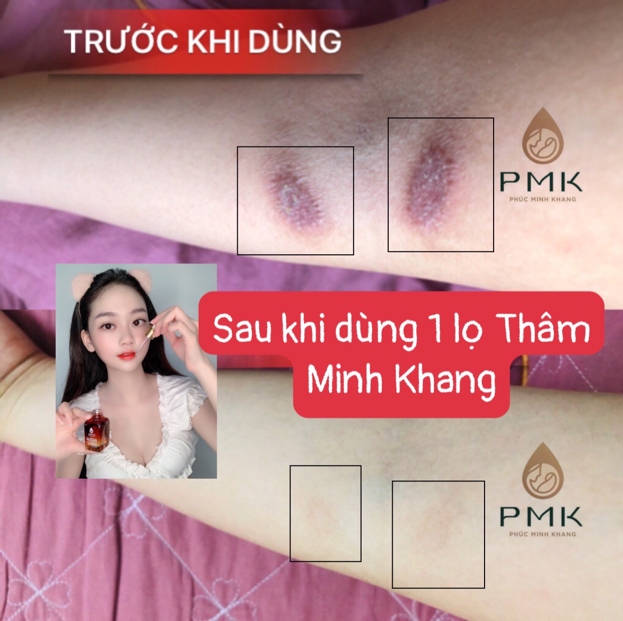 Combo 2 lọ Tinh Chất Mờ Thâm Minh Khang