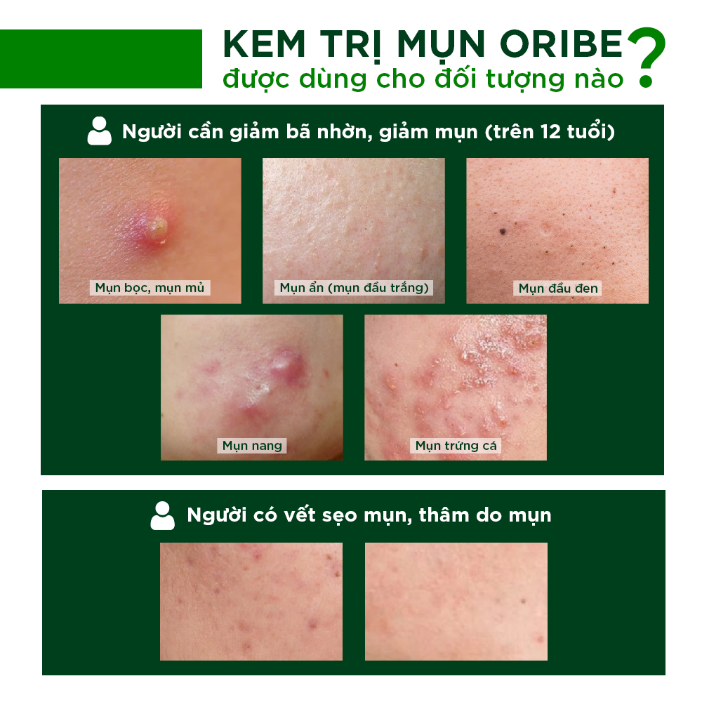 Kem Hỗ Trợ Giảm Mụn Ngừa Thâm Liền Sẹo Ori'be Chiết Xuất Tảo Nâu Từ Pháp Tuýp 20g