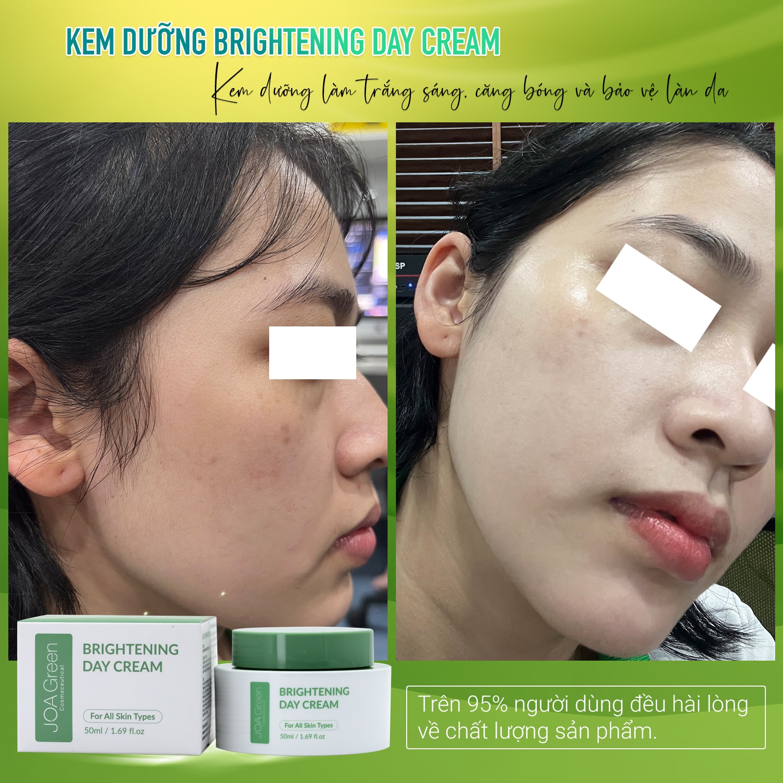 Kem Dưỡng Da Mặt Brightening Day Cream 50ml - JOA GREEN Giúp Phục Hồi, Dưỡng Trắng Da Và Cải Thiện Nếp Nhăn – Mỹ Phẩm MS COSMETIC