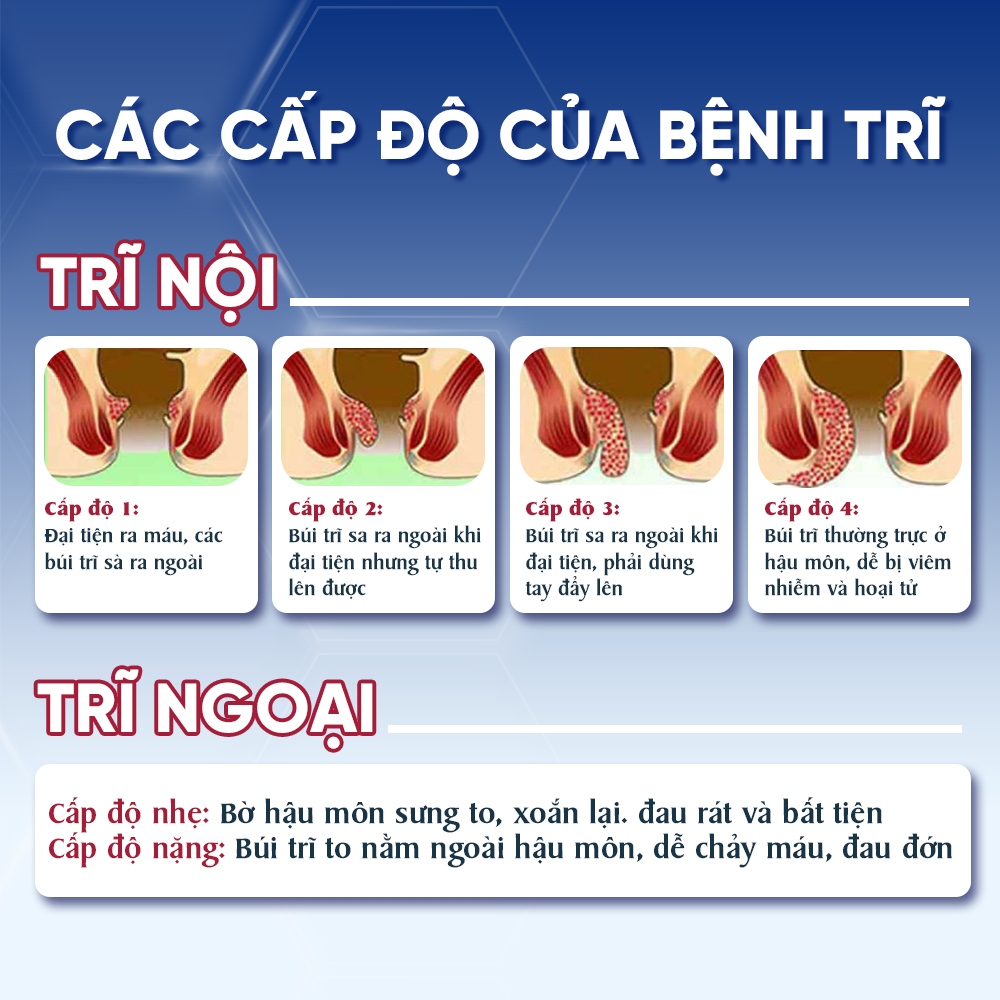 Viên Uống Hỗ Trợ Co Thắt Búi Trĩ Trimax Hủ 30 Viên Nguyên Liệu Từ Thiên Nhiên