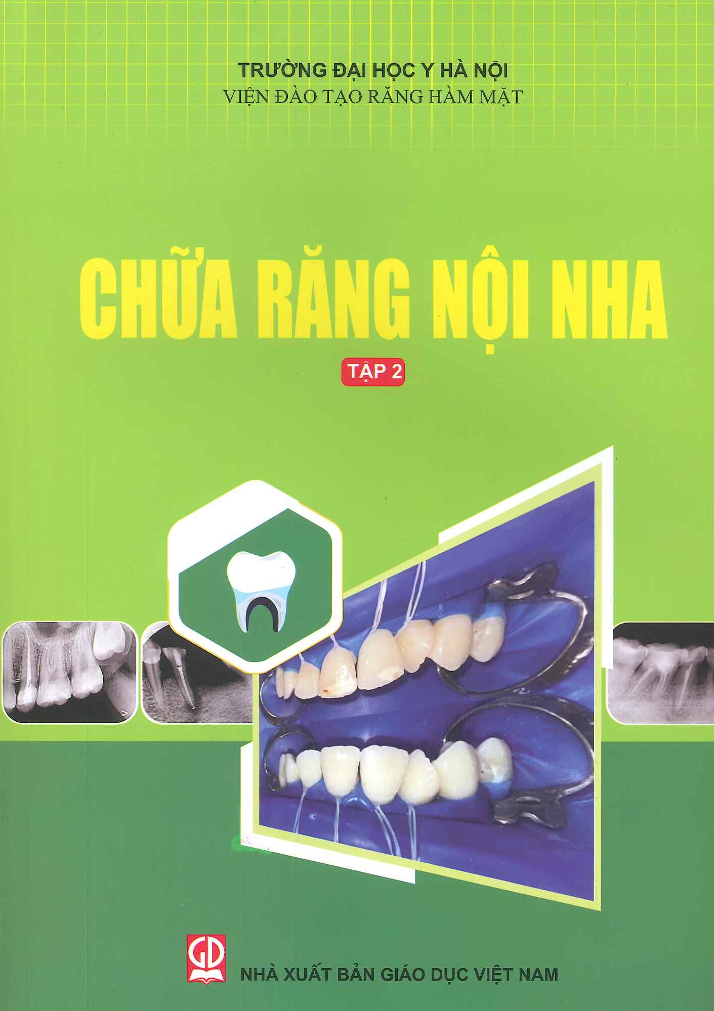 Chữa Răng Nội Nha - Tập 2 (Tái bản lần thứ hai năm 2024) - Viện Đào Tạo Răng Hàm Mặt - Trường Đại Học Y Hà Nội (PGS.TS. Trịnh Thị Thái Hà chủ biên)