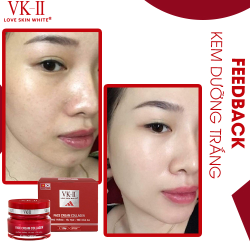 Kem dưỡng trắng, tái tạo và trẻ hóa da VK-II Love Skin White Face Cream Collagen 20g