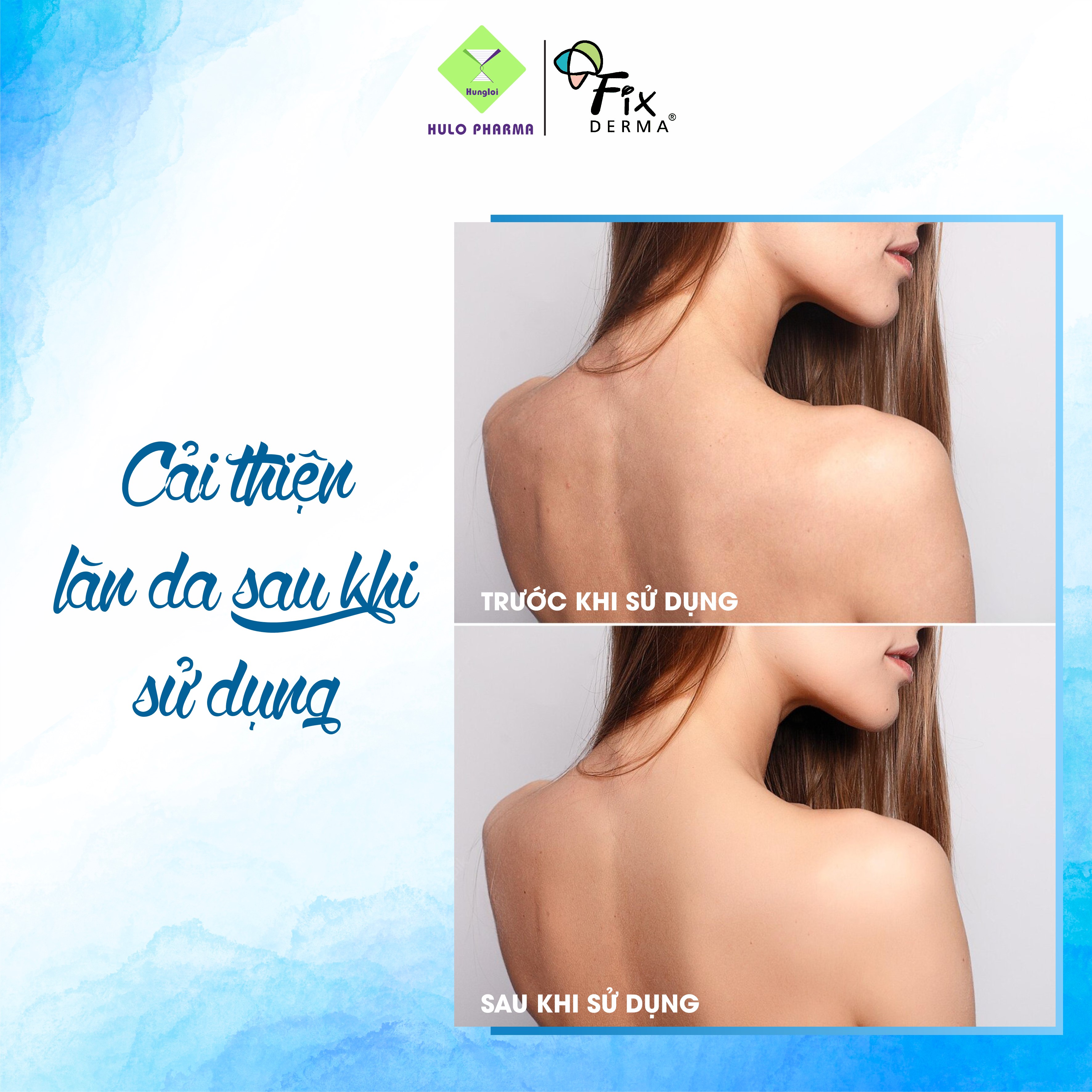 Sữa Dưỡng Thể FCL Pre+ Probiotic Body Lotion 200ml Phục Hồi Da, Giảm Dày Sừng Nang Lông - Hùng Lợi