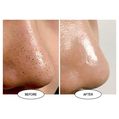 Dung dịch làm sạch mụn đầu đen và bã nhờn One Days You P.Z Ssoc Ssoc No More BlackHead - Pore Clearing 100ml