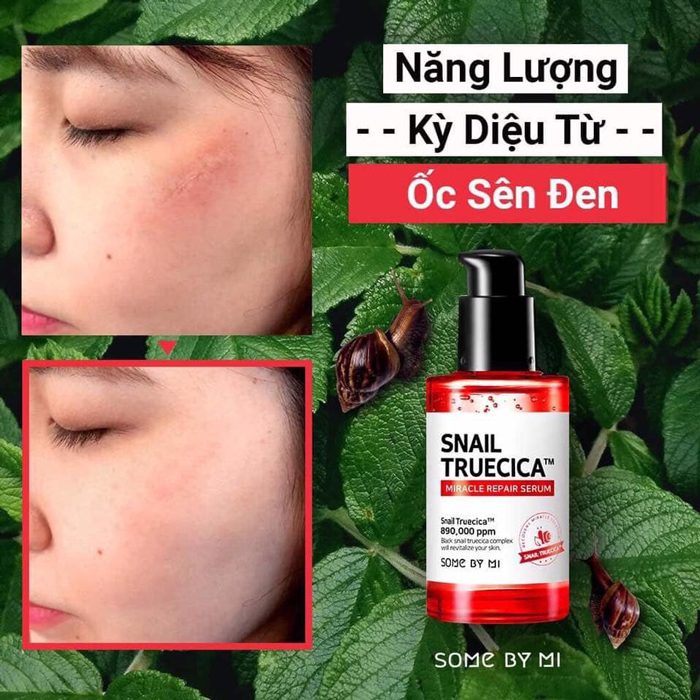 Combo Nước Hoa Hồng + Serum Dưỡng Phục Hồi, Cải Thiện Vết Thâm, Sẹo Some By Mi Snail Truecica Miracle Repair