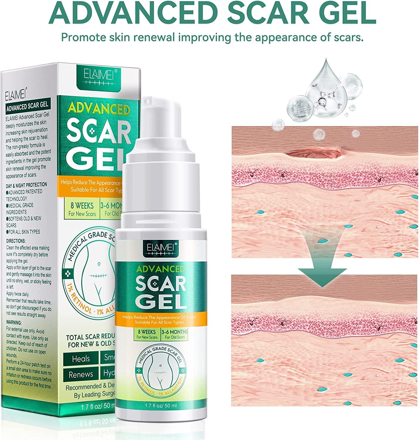 Silicone Scar Gel - Kem sẹo nâng cao, làm mềm và làm phẳng các vết sẹo cũ và mới do mổ lấy thai, phẫu thuật, mụn trứng cá, vết rạn da 50ml