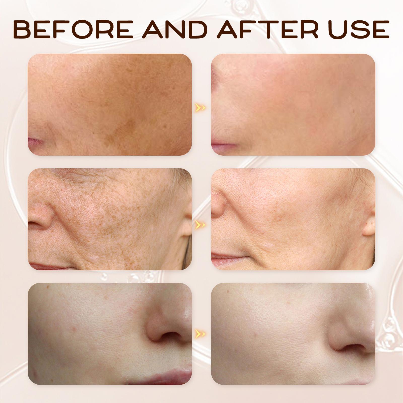 EELHOE 30ml Vitamin E Serum Brightens Skin Tone Hydrates Moisturizes Nourishes Lightens Spots and Wrinkles Serum