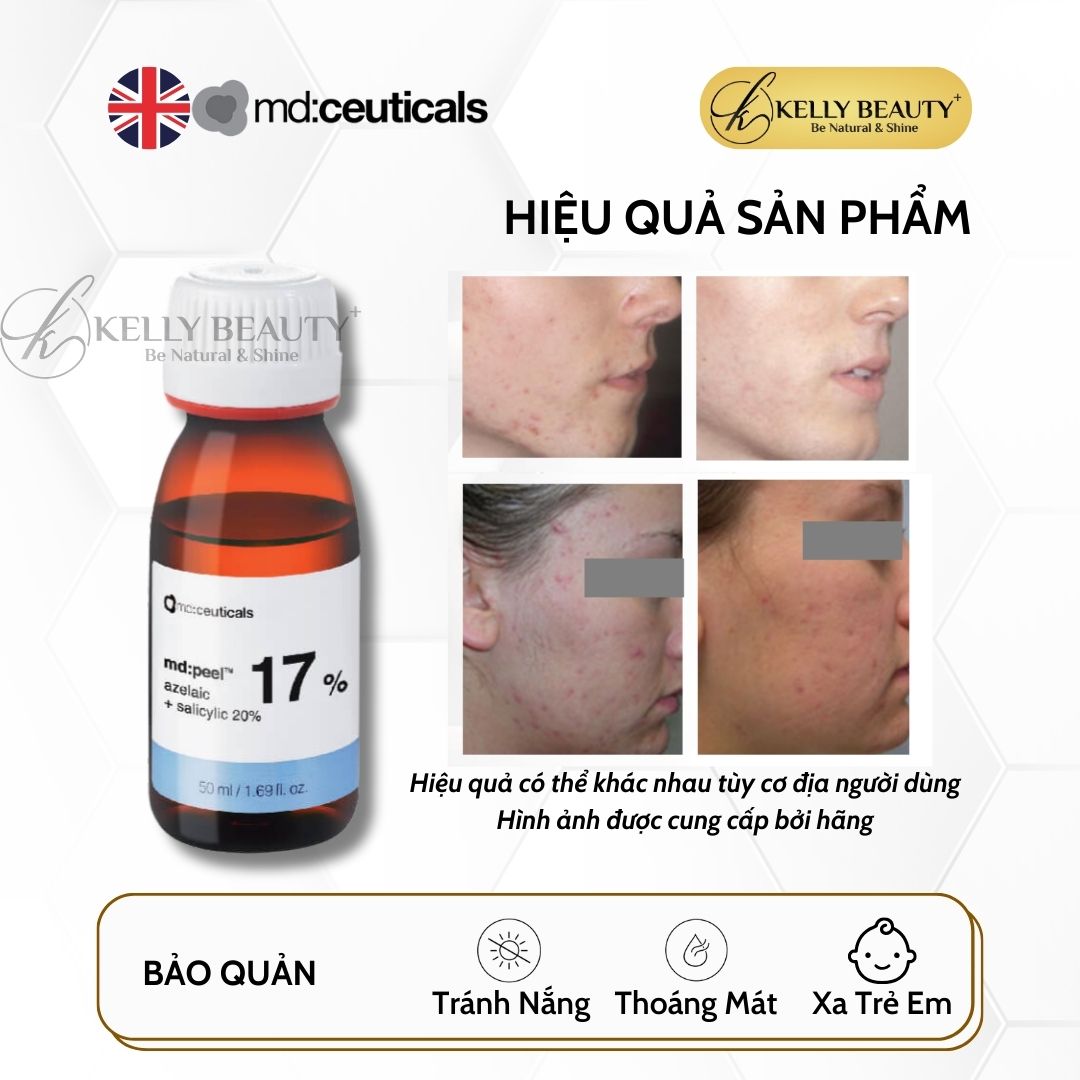 Peel Da Mụn MD:PEEL Azelaic 17% + Salicylic 20% - MD:Ceuticals | Kelly Beauty