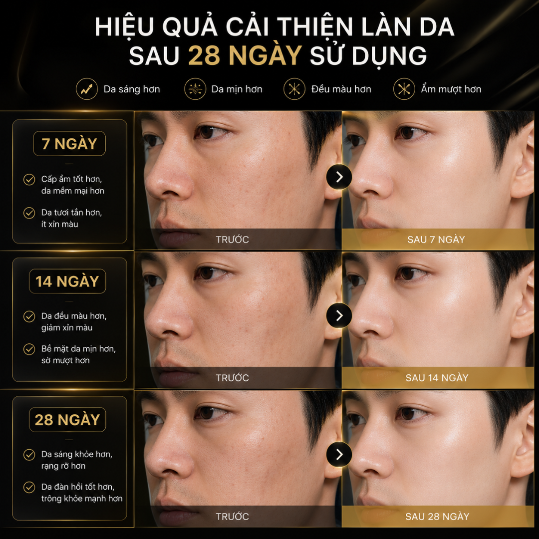 Serum dưỡng trắng da DÀNH CHO NAM MENGEN Niacinamide 10% Brightening Serum hỗ trợ mờ thâm mụn, sạm nám 35ML