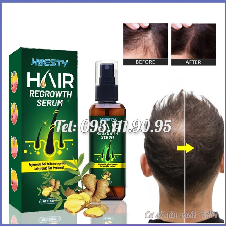 Serum dưỡng mọc tóc, giúp tóc mọc nhanh, nhiều và dày, sợi tóc đen bóng xuất xứ Nhật Bản – Mã số 1230