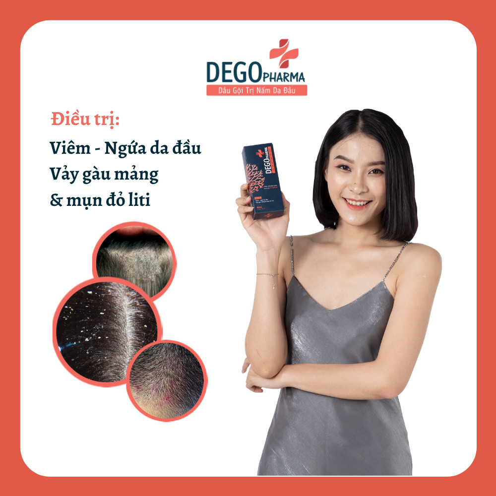 Combo 03 dầu gội sạch gàu hết ngứa Dego Pharma chiết xuất hoàn toàn từ thiên nhiên an toàn với người sử dụng có dung tích 80ml