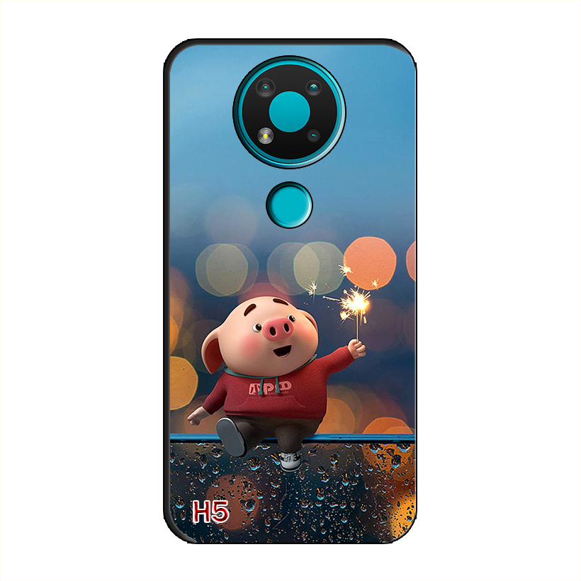 Ốp Dẻo Dành Cho NOKIA 3.4