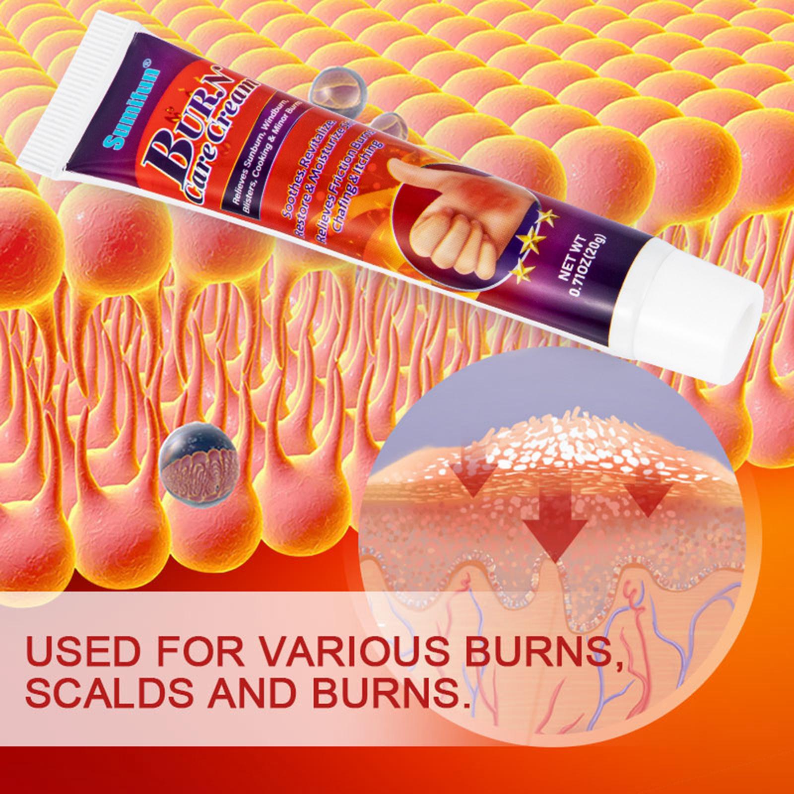 Sumifun 20g Skin Burn Care Cream Relieve Sunburn Windburn Blisters Cooking Burns Healing Care Moisturize Skin