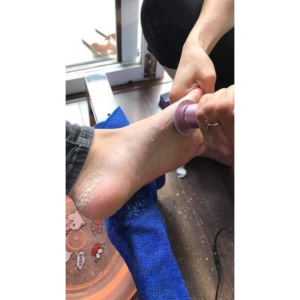 Máy Chà Gót Chân, Tẩy Tế Bào Chết Cho Tiệm Nail, Cá Nhân Tại Nhà-Tặng Kèm 60 Miếng Chà