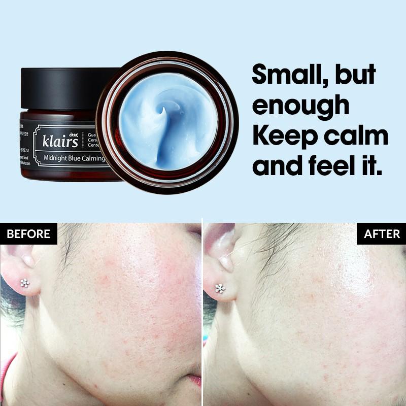 Kem Dưỡng Ẩm, Làm Dịu Và Phục Hồi Da Ban Đêm Dear Klairs Midnight Blue Calming Cream 30ml