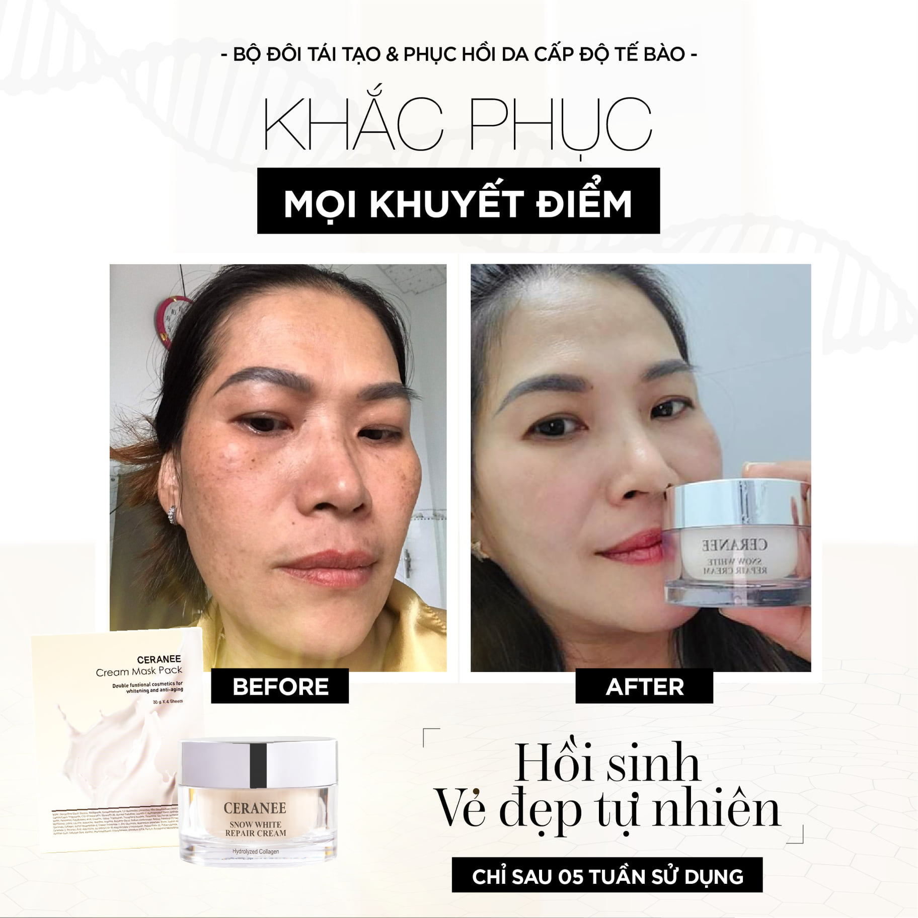 Kem Dưỡng Ẩm Da Làm Trắng Da Phục Hồi Và Chống Lão Hóa Cấp Độ Tế Bào Từ Collagen Tươi Pháp 50gr Ceranee