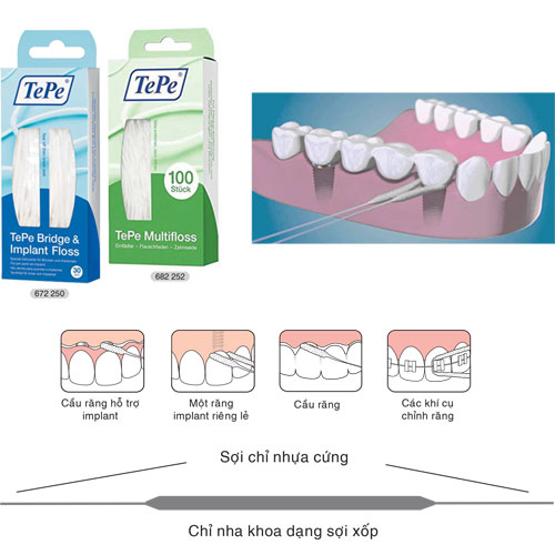 Chỉ nha khoa cho cầu mão răng Tepe Bridge - Implant Floss (5 sợi)