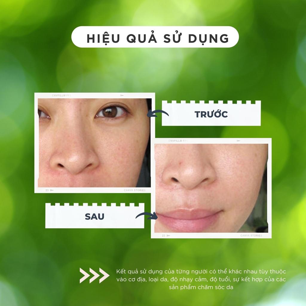 KEM DƯỠNG NGĂN NGỪA LÃO HÓA TINH CHẤT NGỌC TRAI CHAMIS