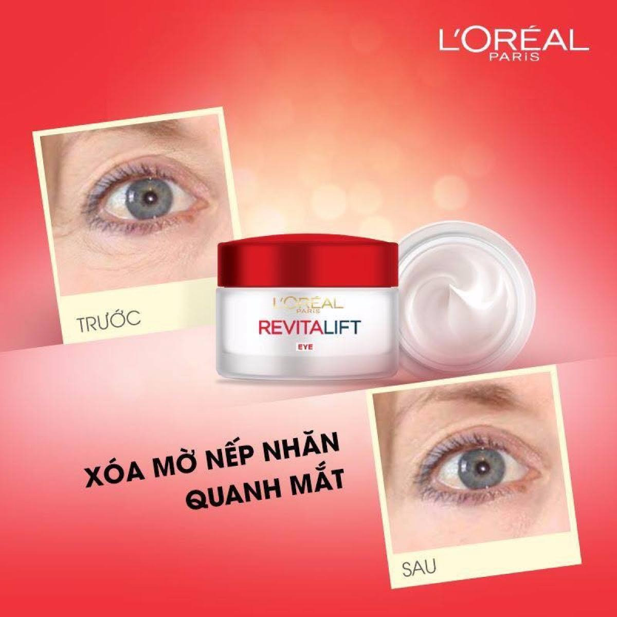 Kem Dưỡng Mắt Săn Chắc &amp; Chống Nhăn L'Oréal Revitalift Double Lifting Eye (15ml)