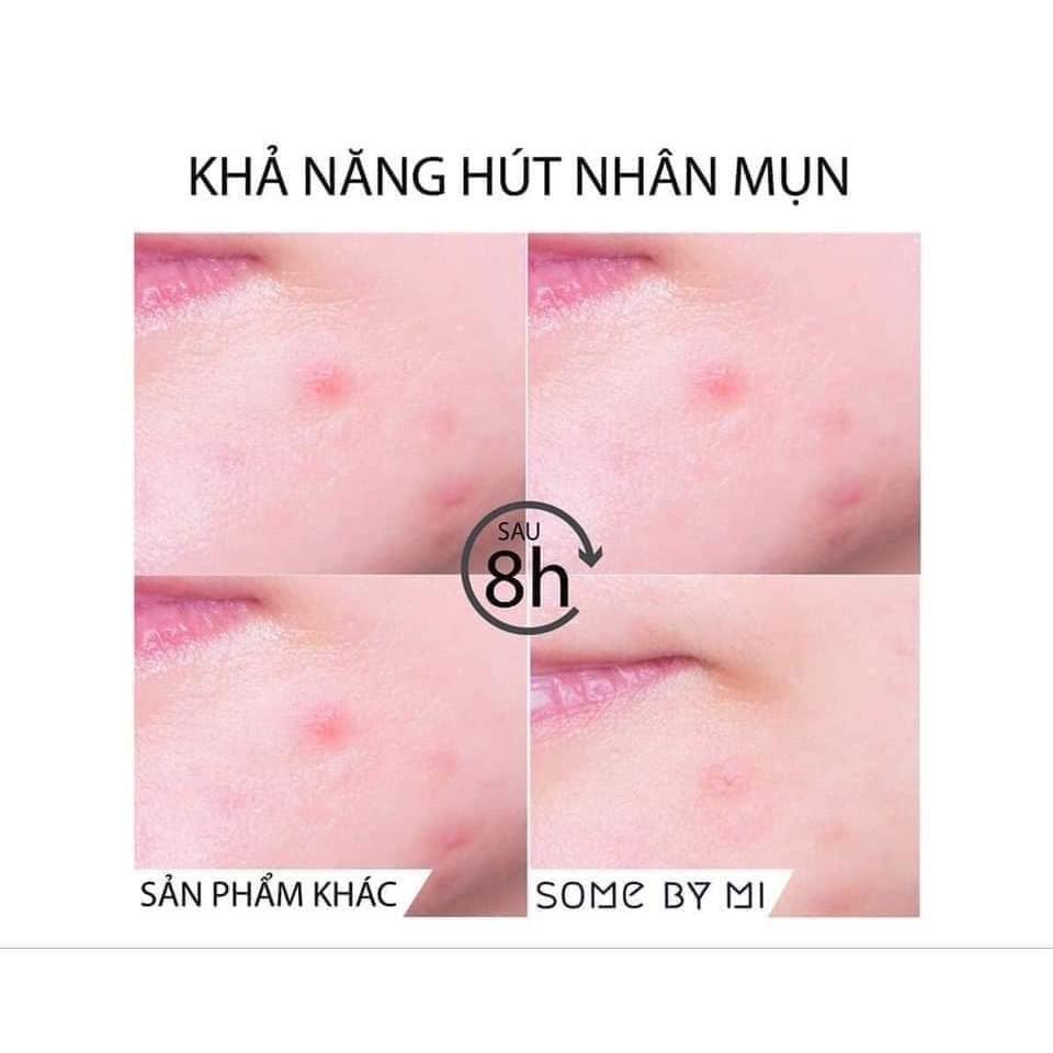 Miếng Dán Mụn Some By Mi Clear Spot Patch (Set 18 miếng)