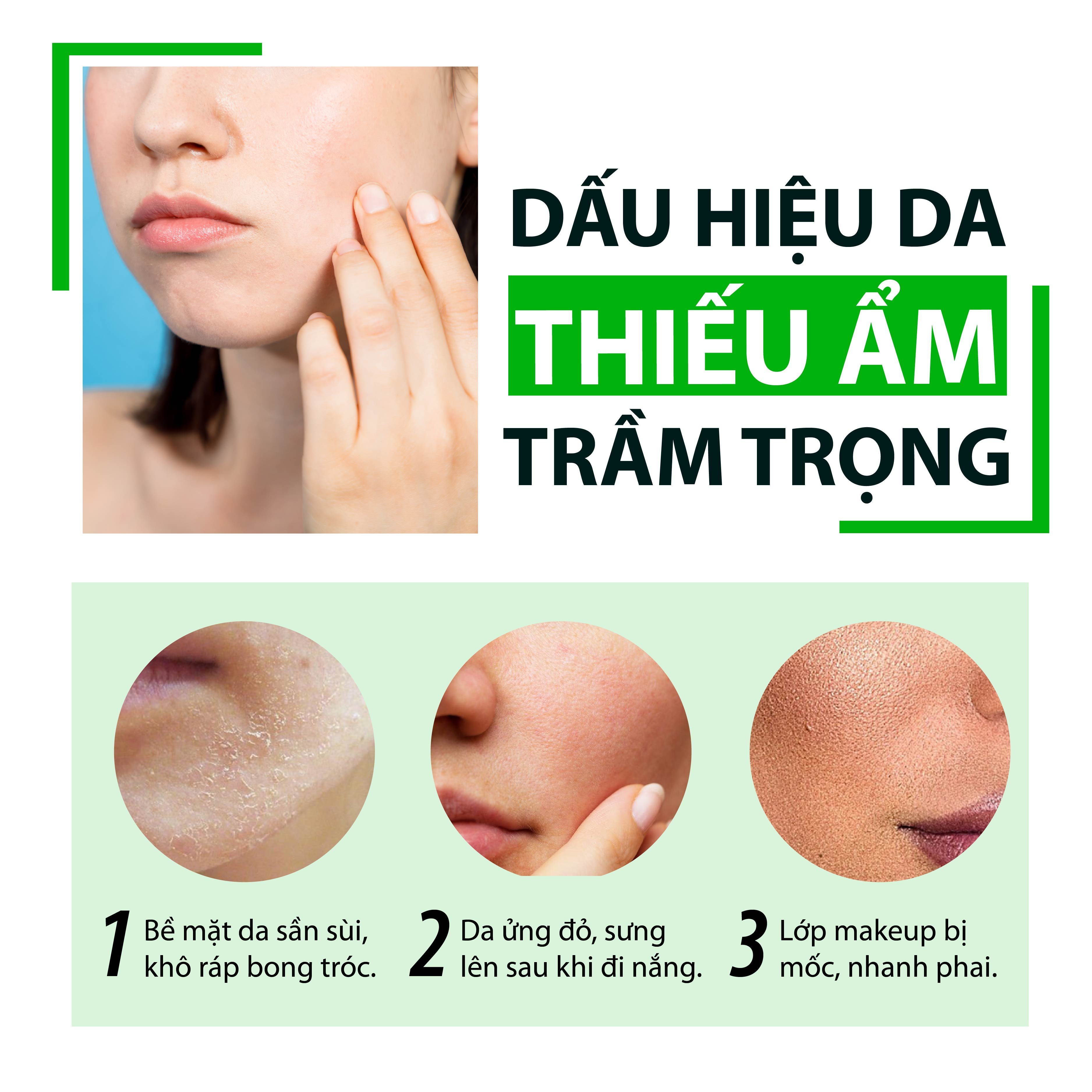 Xịt Khoáng Nha Đam Cấp Nước Tức Thì, Làm Dịu Da &amp; Cân Bằng Độ Ẩm MILAGANICS 100ml (Chai)