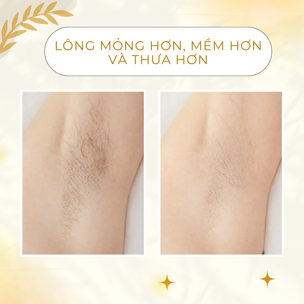 Tinh Chất Ức Chế Mọc Lông Siêu Hoạt Tính POP