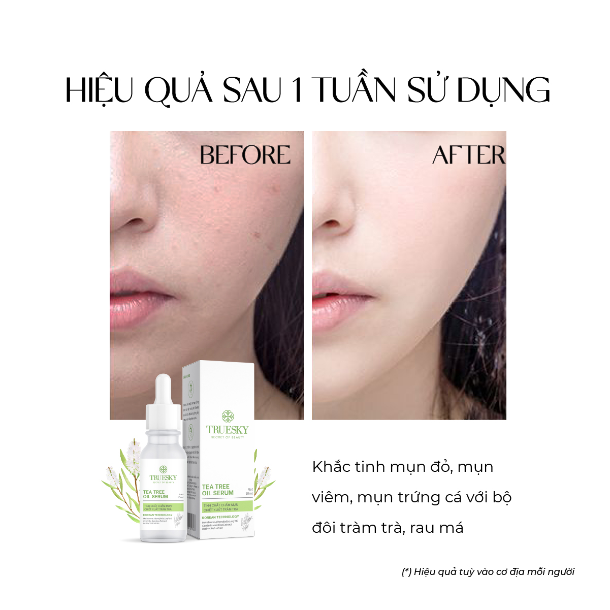 Tinh chất chấm mụn Truesky Tea Tree Oil chiết xuất tràm trà giúp làm dịu da, làm mờ vết thâm và giảm mụn 10ml