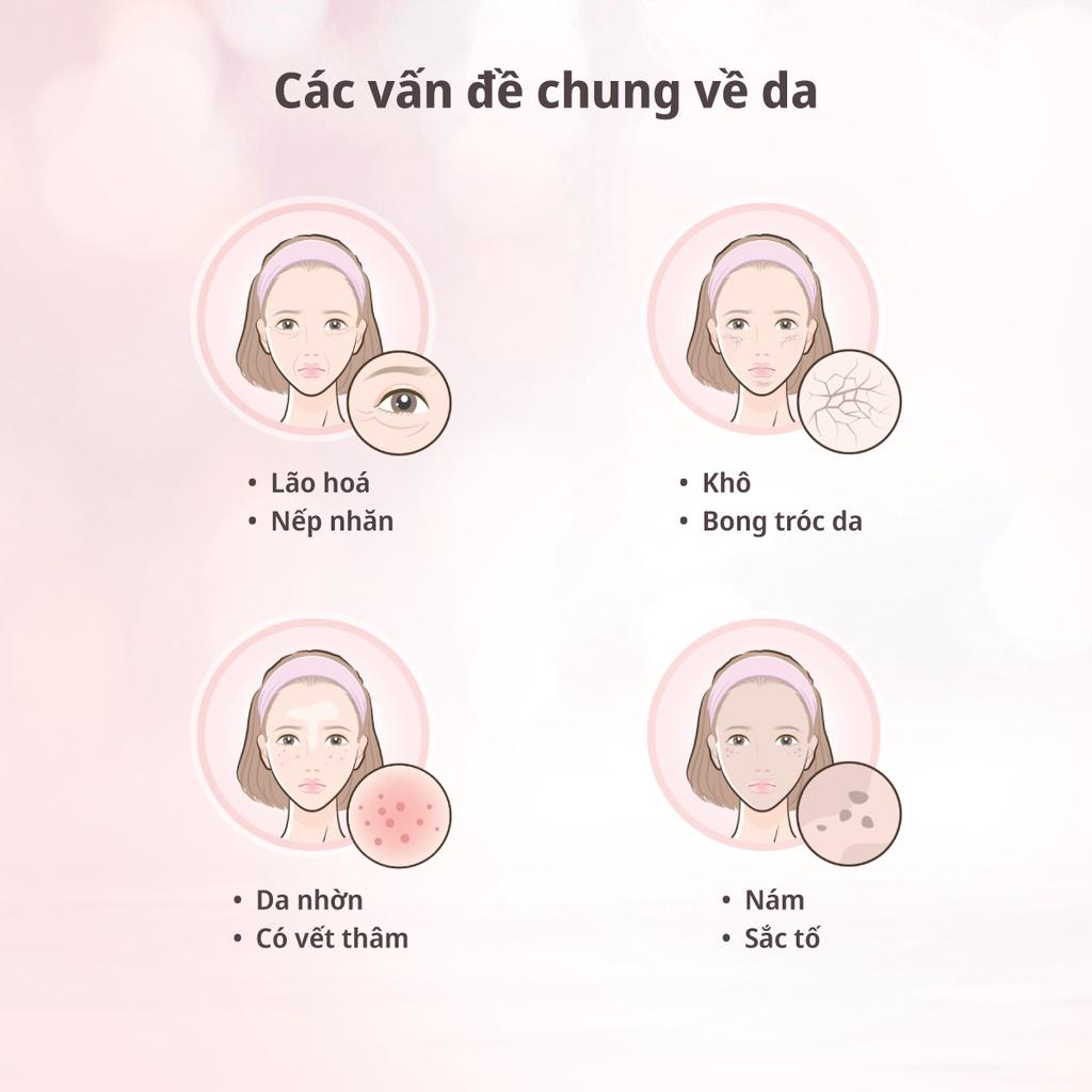 OSIM Máy massage mặt uGlow IonCare